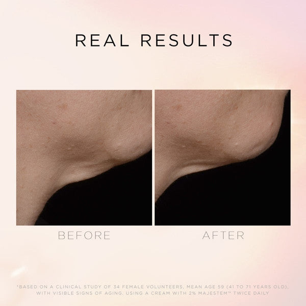 Illuminate & Lift Neck & Décolleté Treatment